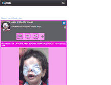 Tablet Screenshot of ameloperationvisage.skyrock.com