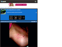 Tablet Screenshot of eczema.skyrock.com