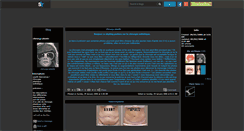 Desktop Screenshot of chirurgy-plastik.skyrock.com